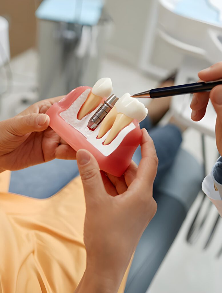 Implant